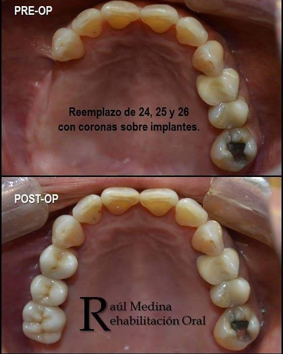 Raúl Uriel Medina Martinez-7