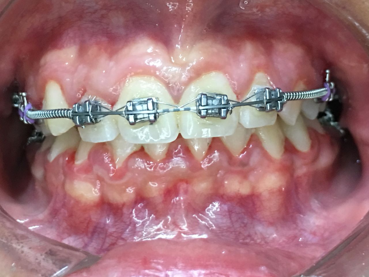 Patricia Rizo Palos-10