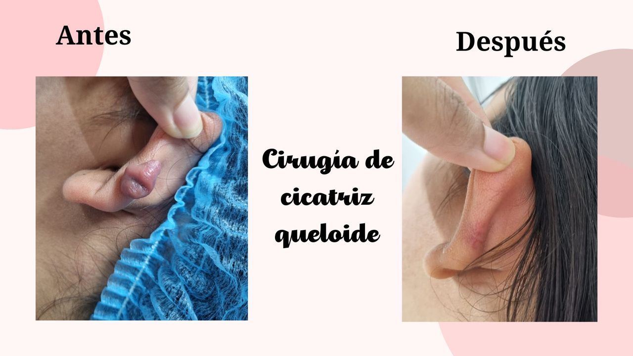 Yuriria Gálvez Juárez-2