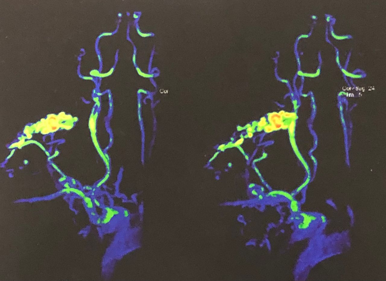 Miguel Abraham Lara Perez-15