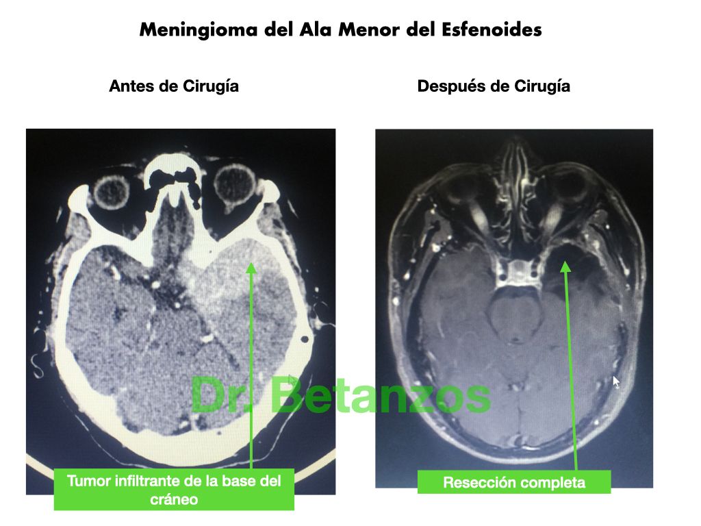 Aleixandre Betanzos Villegas-7