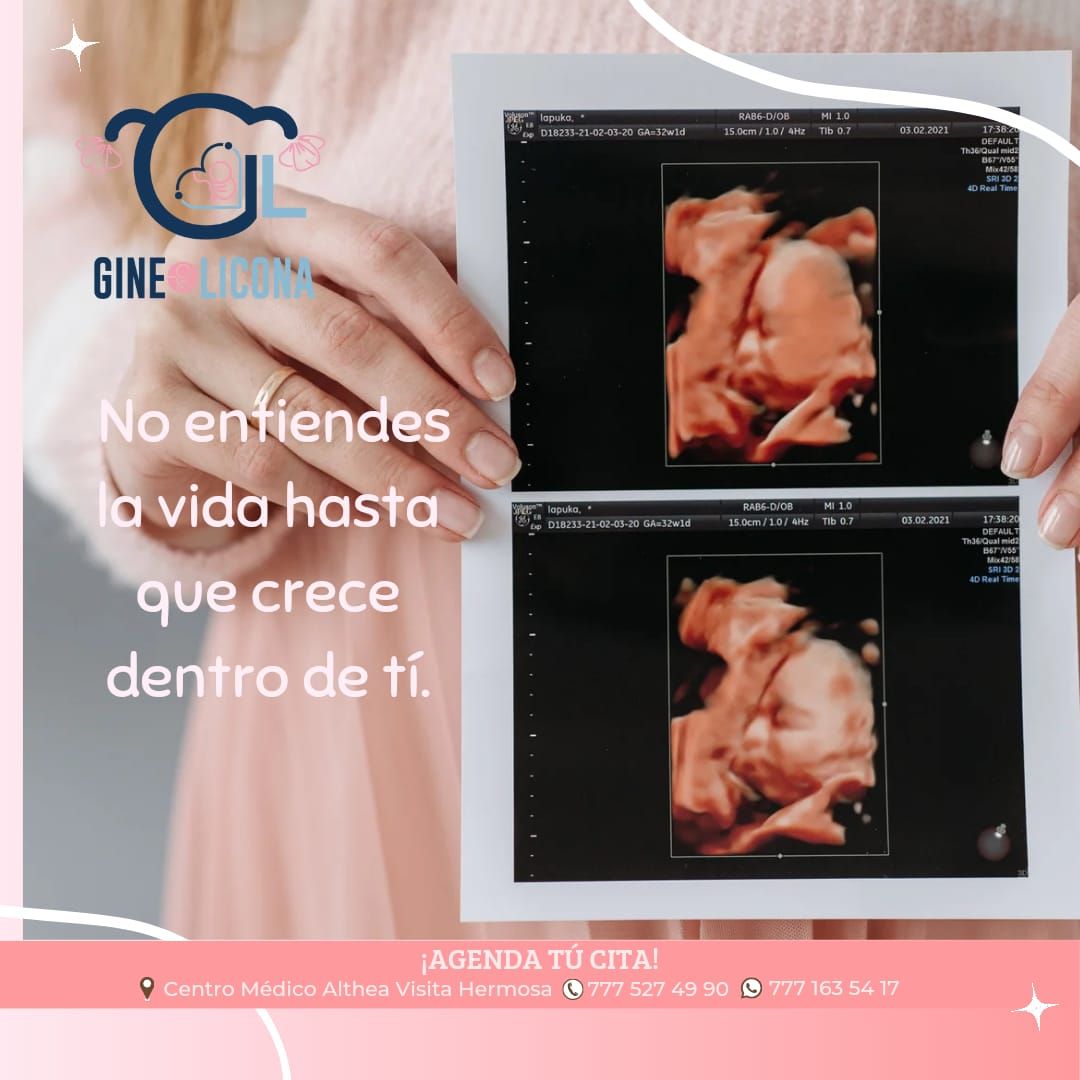 Alejandra Gómez Licona-5