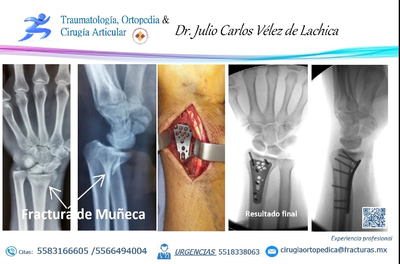 Julio Carlos Vélez De Lachica-44