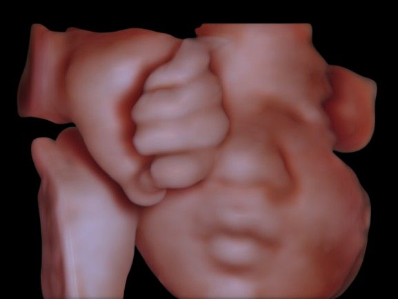 Rodolfo Antonio Gurrola Ochoa-2