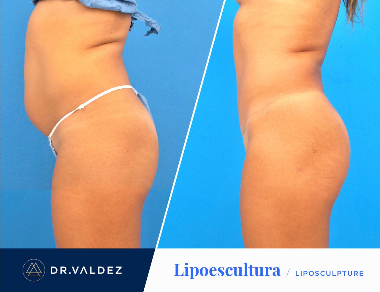 Pedro Arturo Valdez Gomez-18