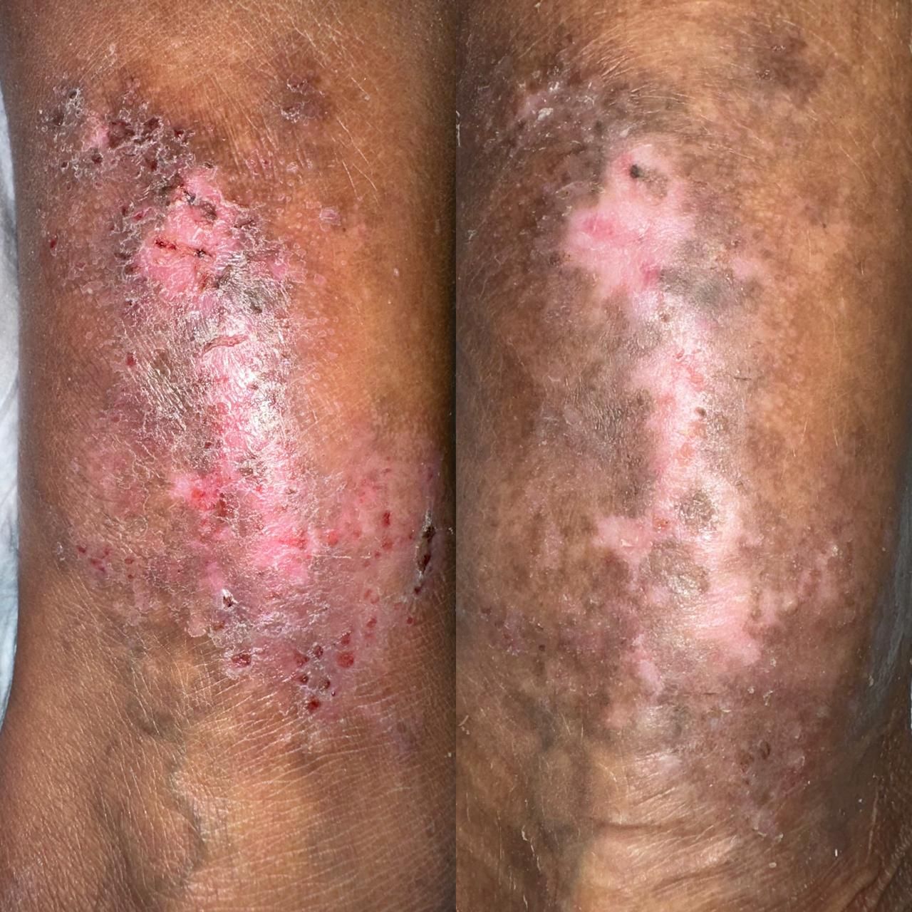 Jhonatan López González-25