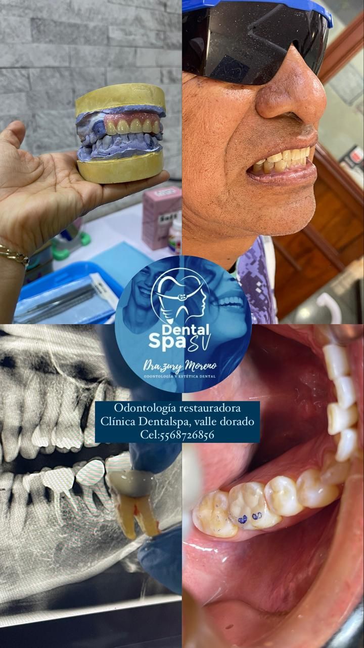 Zury Sarai Moreno Soto-9