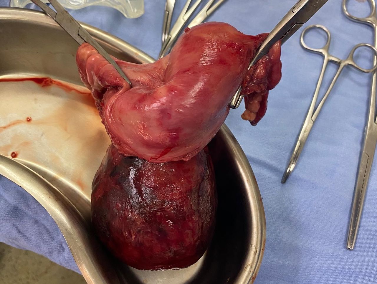 Andrea Calvo Maldonado-2