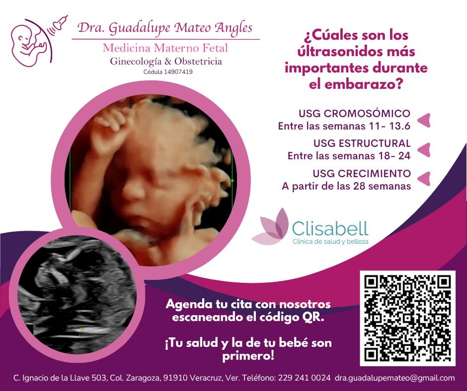 Guadalupe Mateo Angles-1