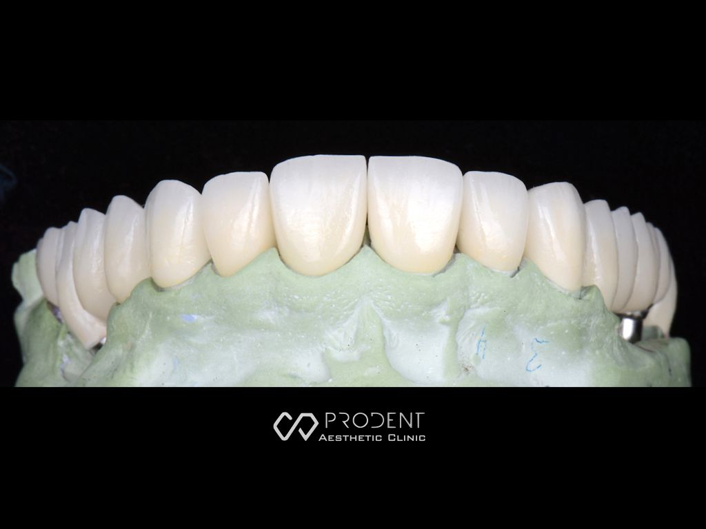 Ramiro Ivan Pérez Murillo-54