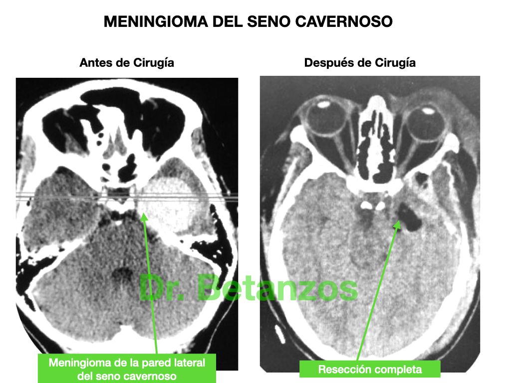 Aleixandre Betanzos Villegas-21
