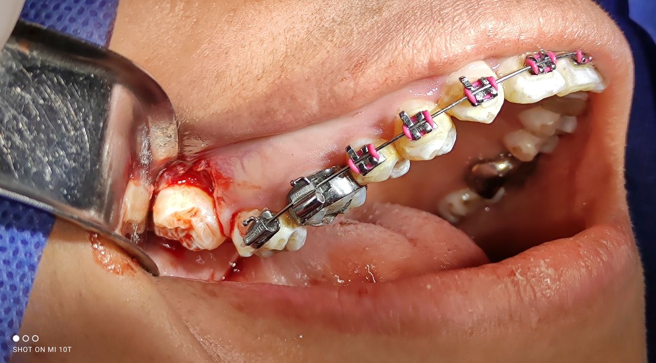 Edgar Antonio Zavala Alvarado-4