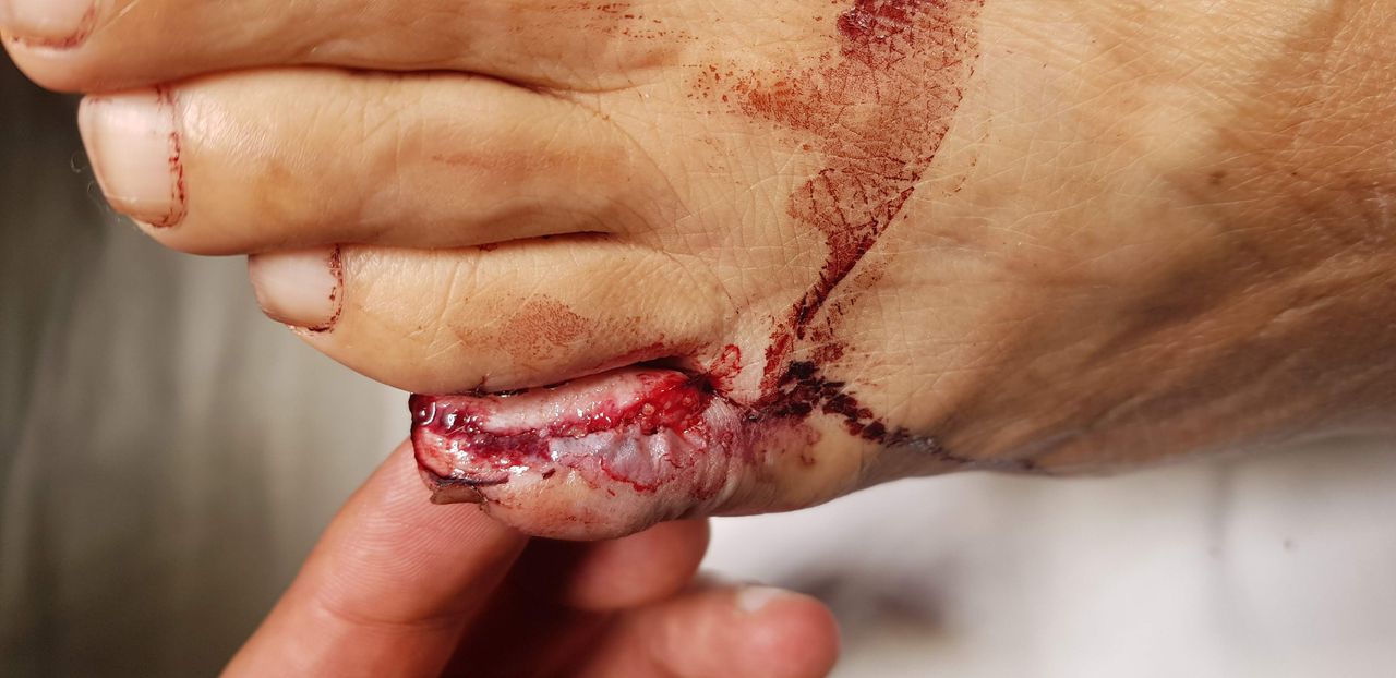 José Antonio Algarín Reyes-35