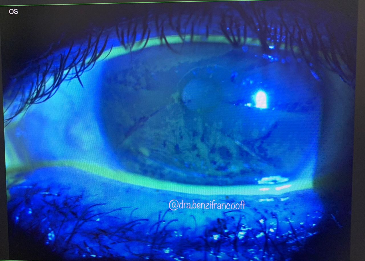 Benazir Franco Mojica-0