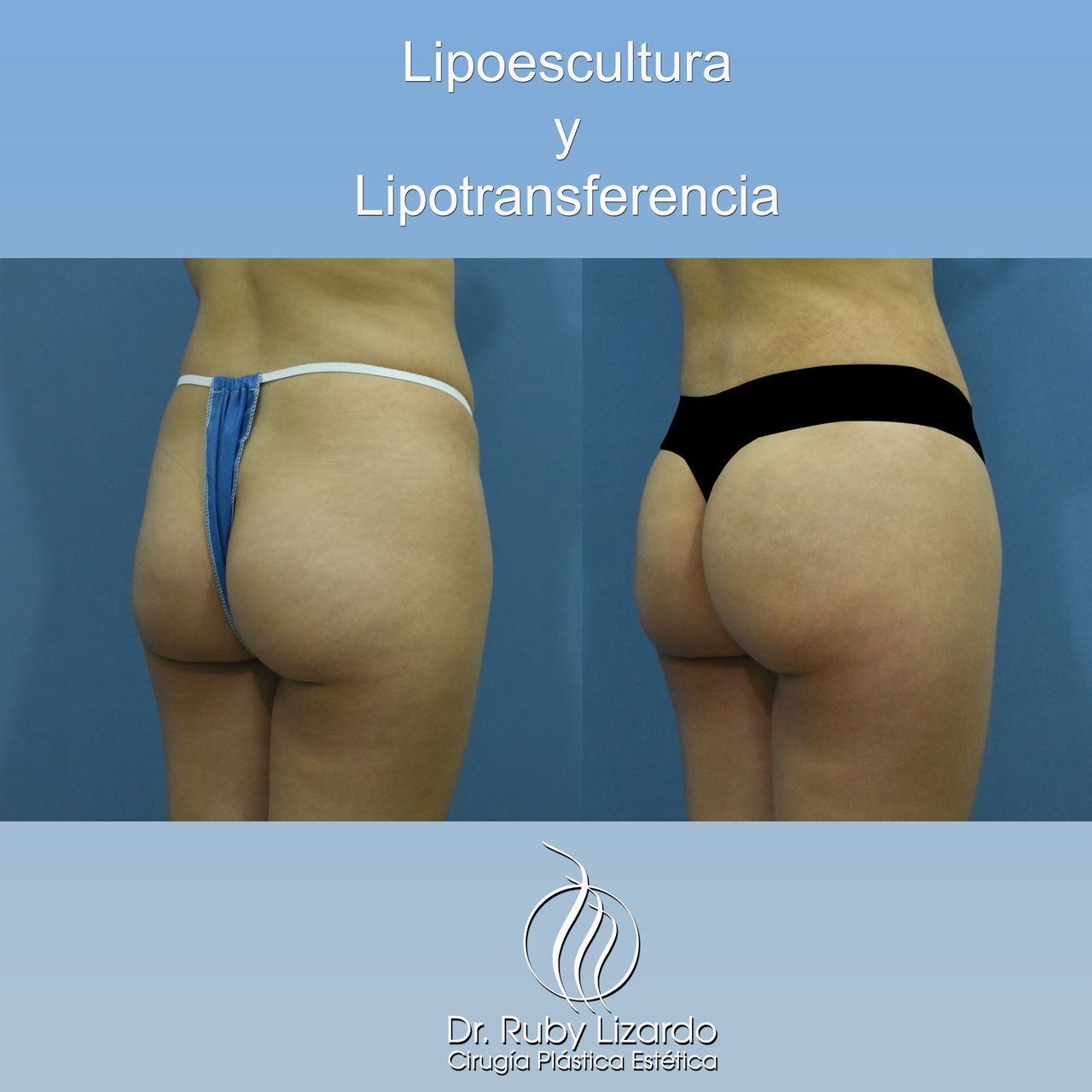 Ruby Lizardo Ramírez Robles-3