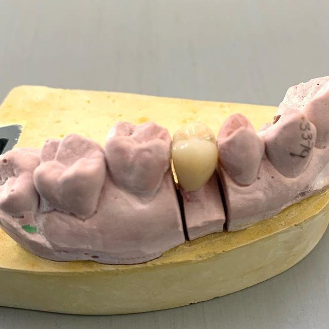 Alejandro Angelo López Díaz-15