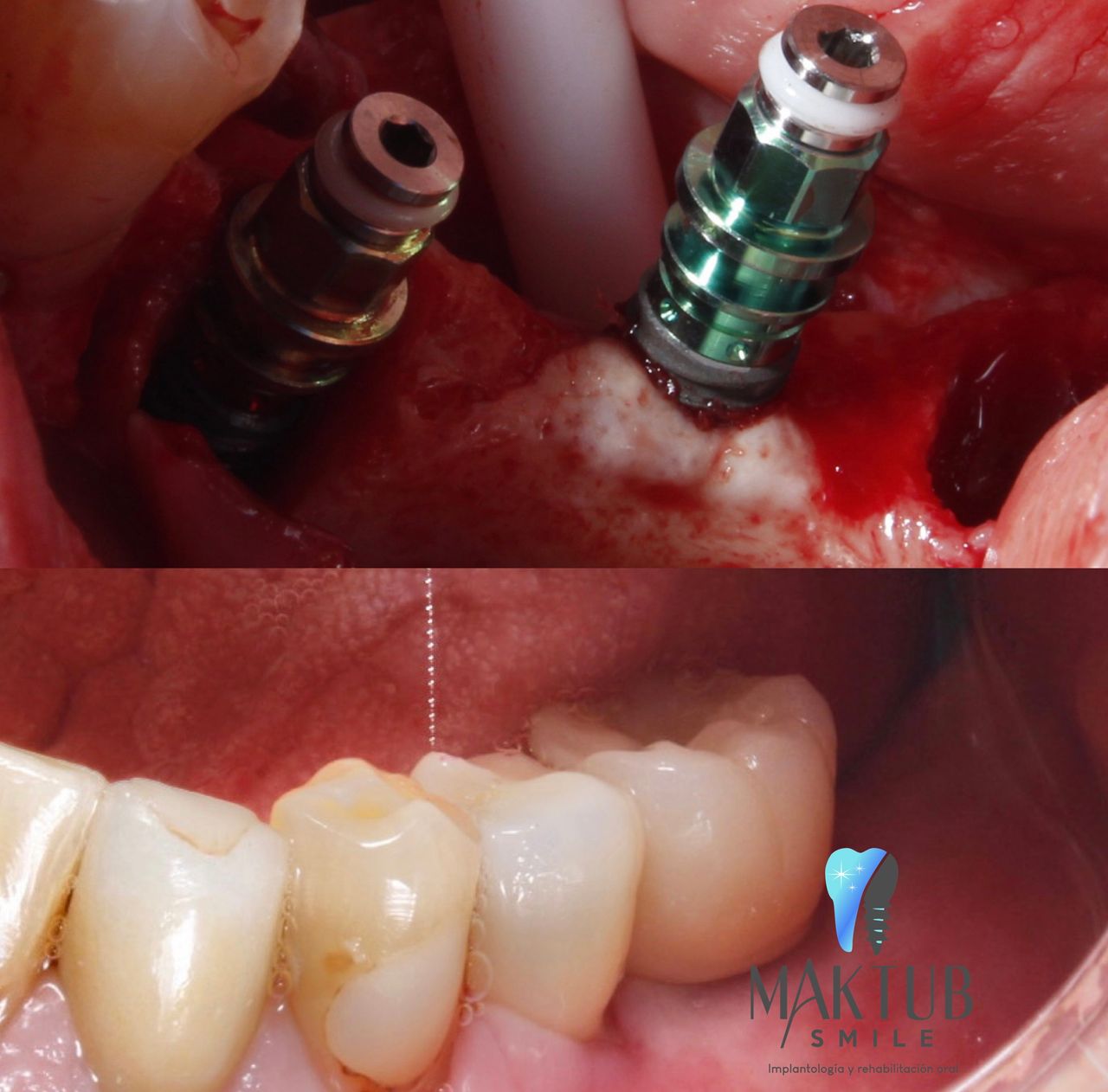 Nairoby Contreras-20