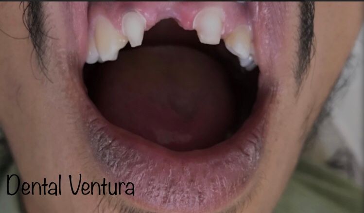 Antonio Cerda Ventura-19