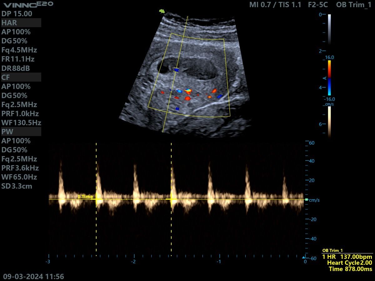 Patricia Elizabeth Torres González-0