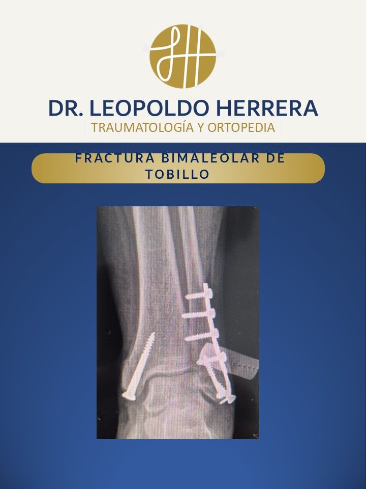Leopoldo José Herrera Camacho-13