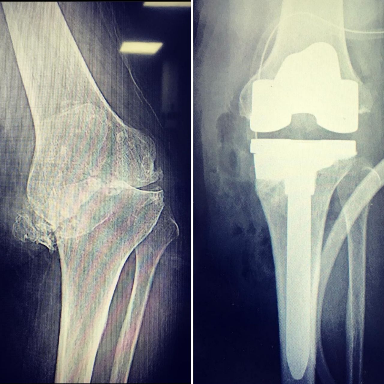 Avelino Colín Vázquez.-6