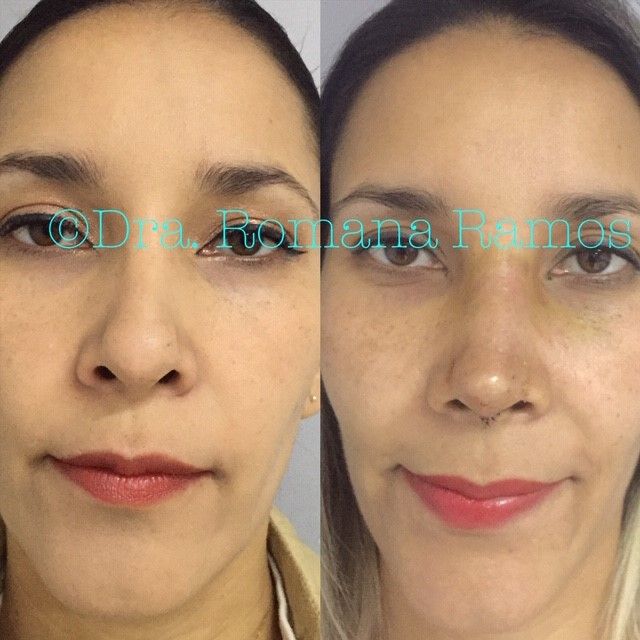 Romana Ramos Cárdenas-19