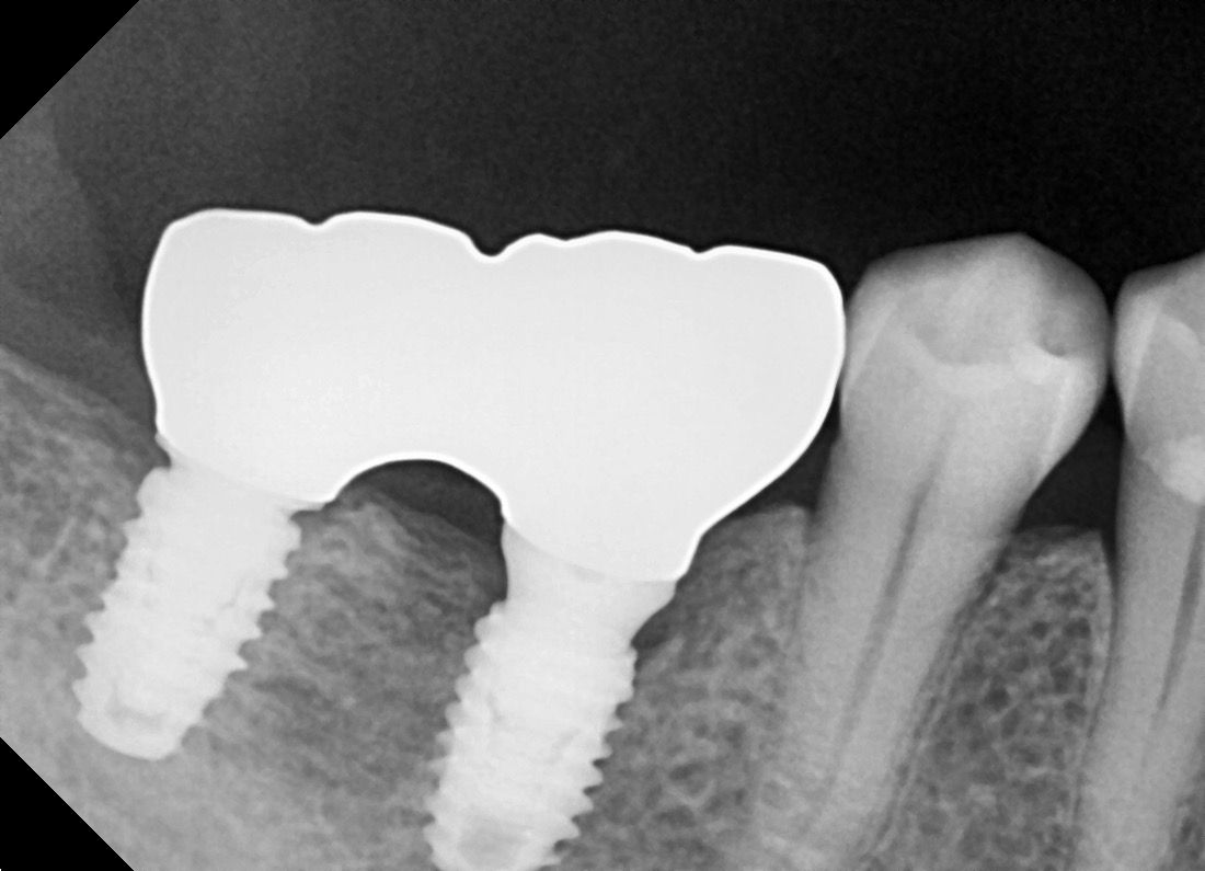 Francisco Jose Vives Serrano-34