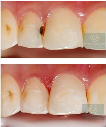 Ana Karen Basulto Cruz-1