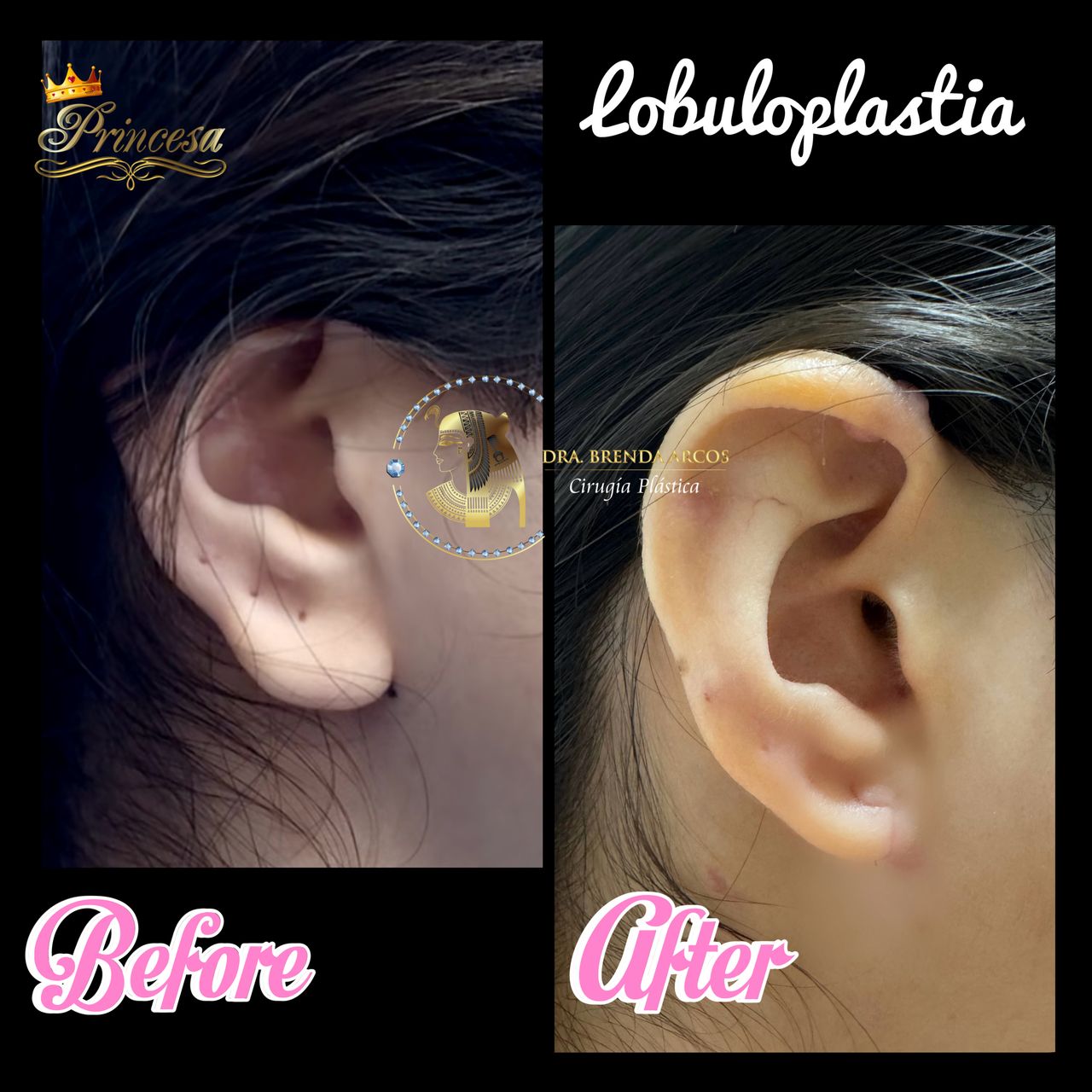 Brenda Arcos Vera-19