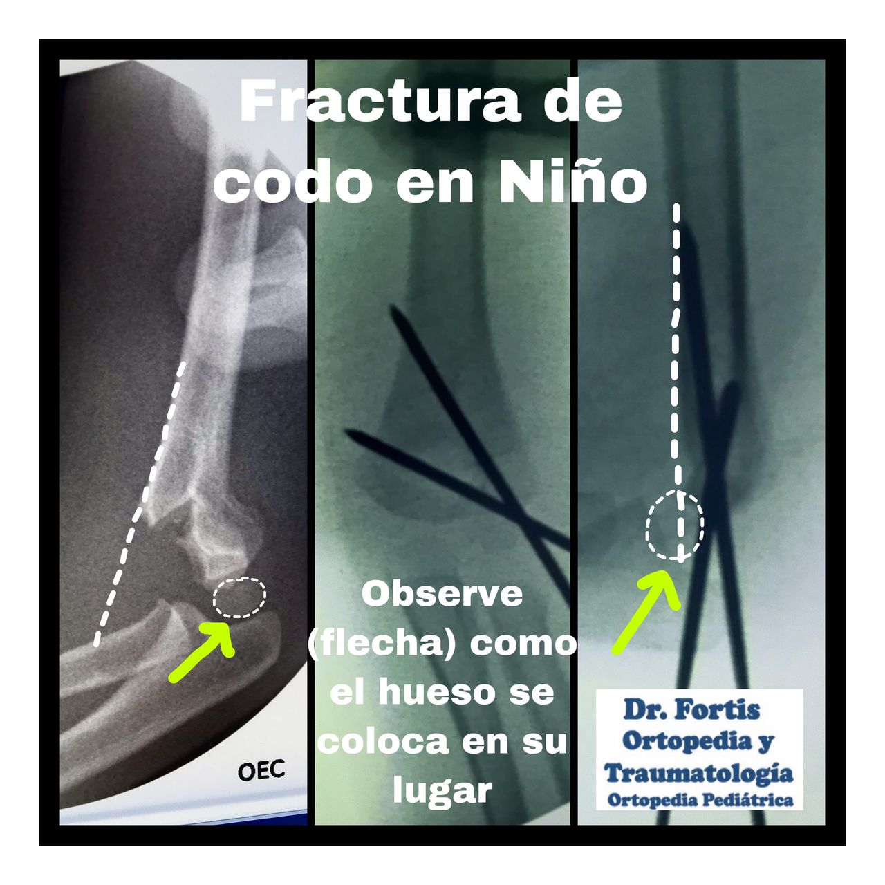 Ignacio Osvaldo Fortis Olmedo-18