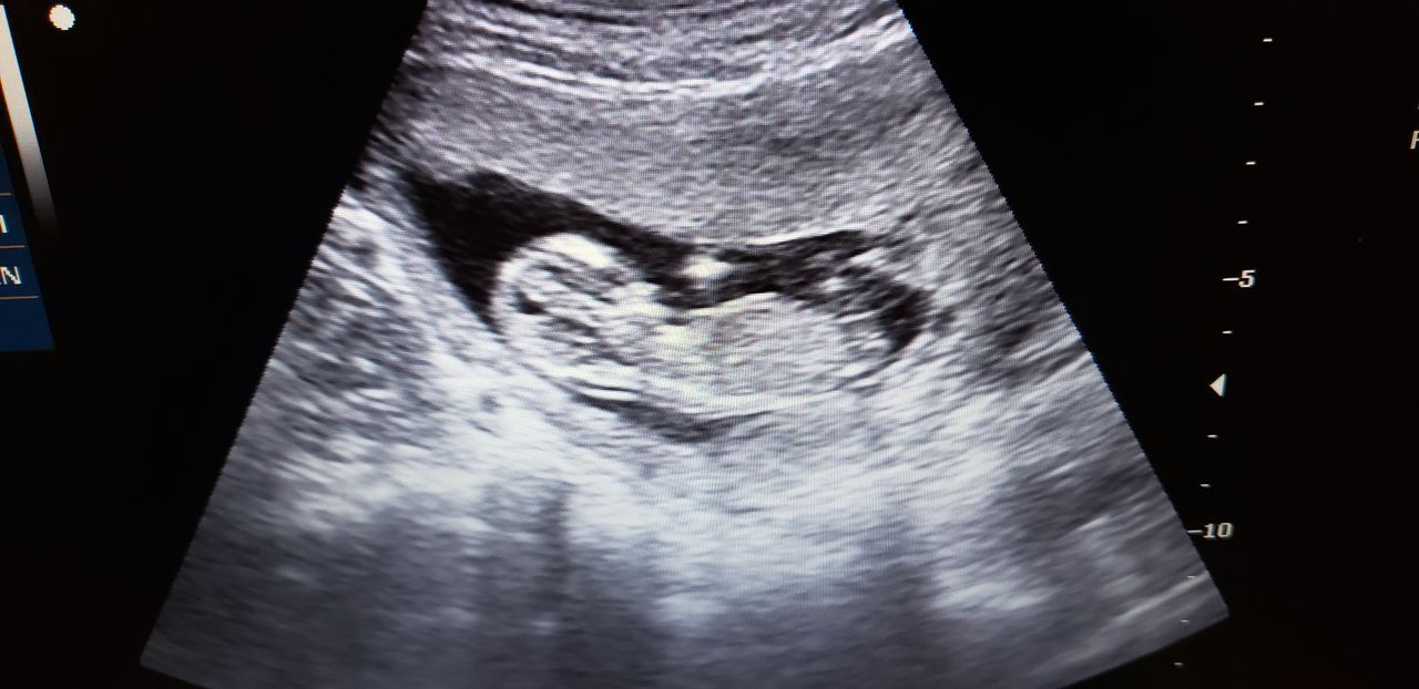 Germán Gabriel Palacios López-27