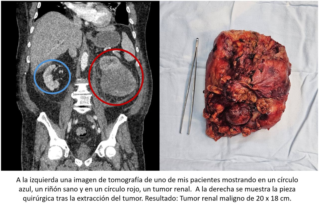 Roberto Pacheco López-2