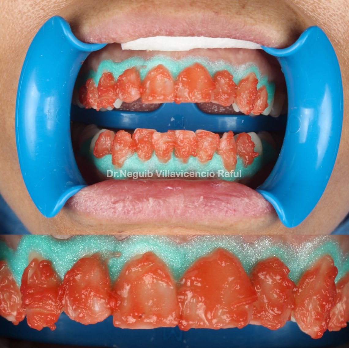 Neguib Villavicencio Raful-17