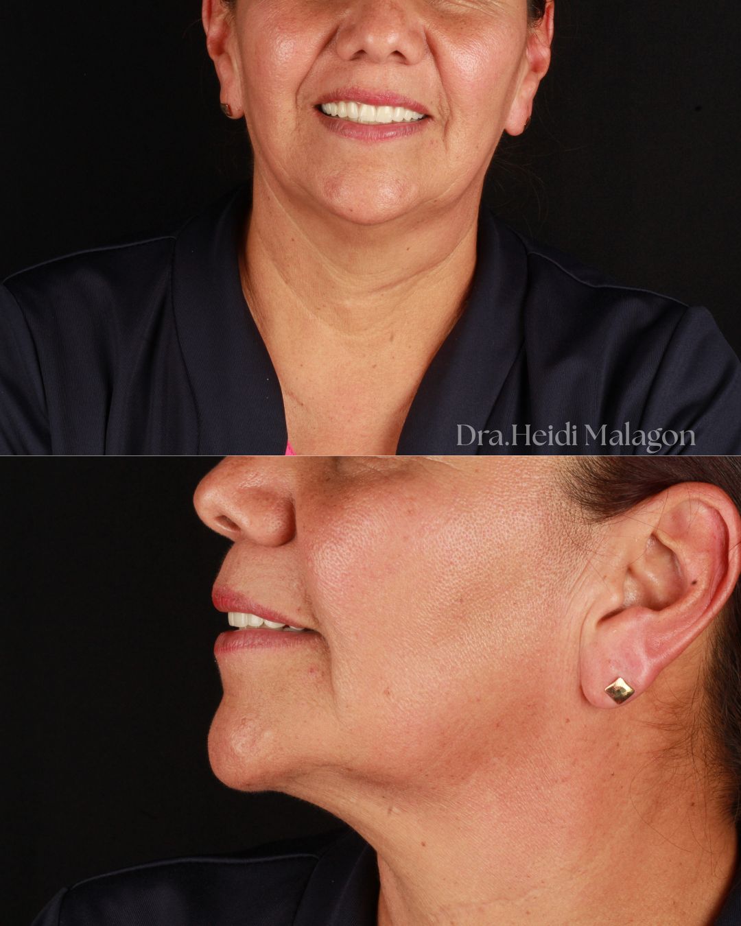 Heidi Mendoza Malagón-5