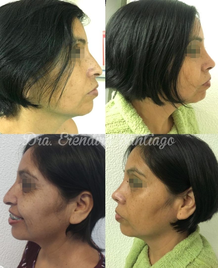 Erendira Santiago Santiesteban-4