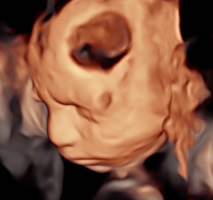 Ricardo Morales Velázquez-4