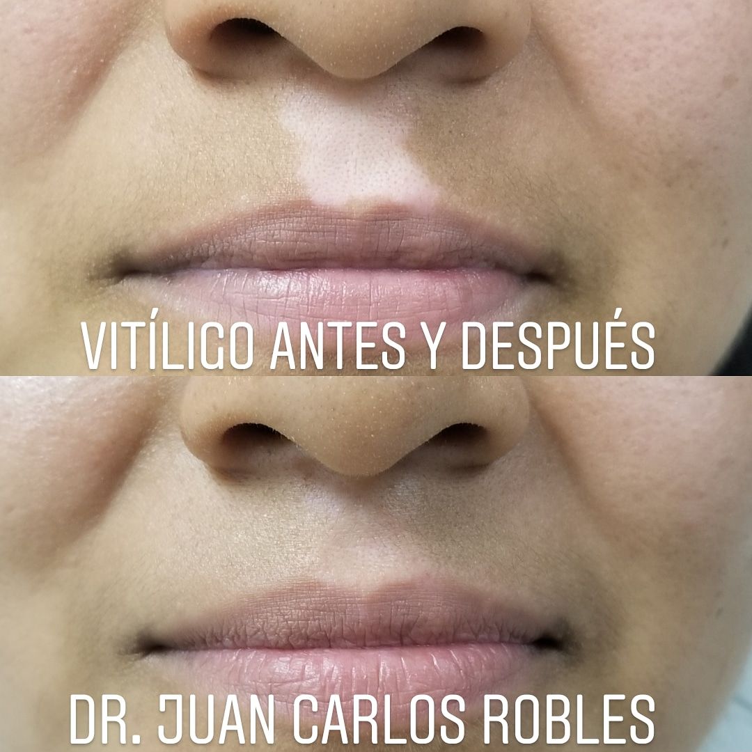 Juan Carlos Robles Méndez-21