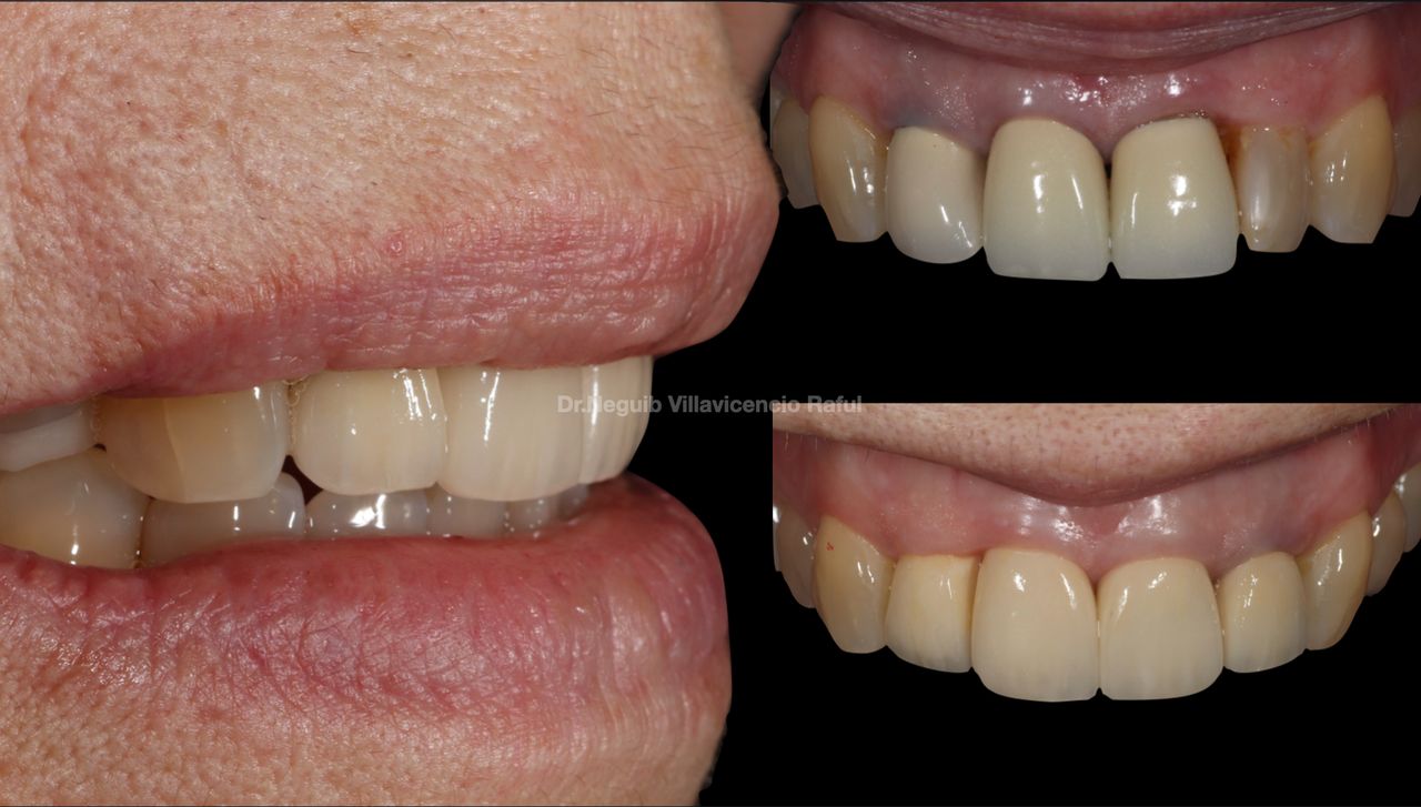 Neguib Villavicencio Raful-49