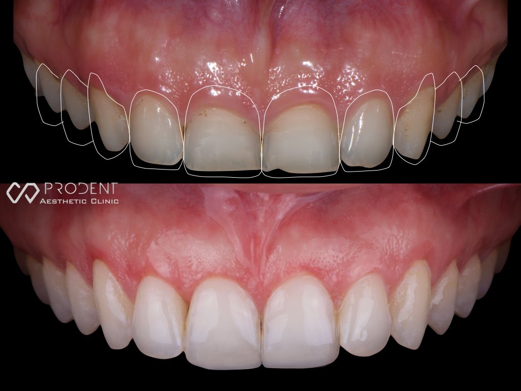 Ramiro Ivan Pérez Murillo-59