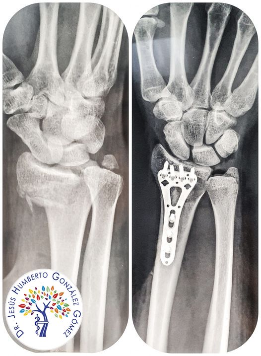 Jesús Humberto González Gómez-6