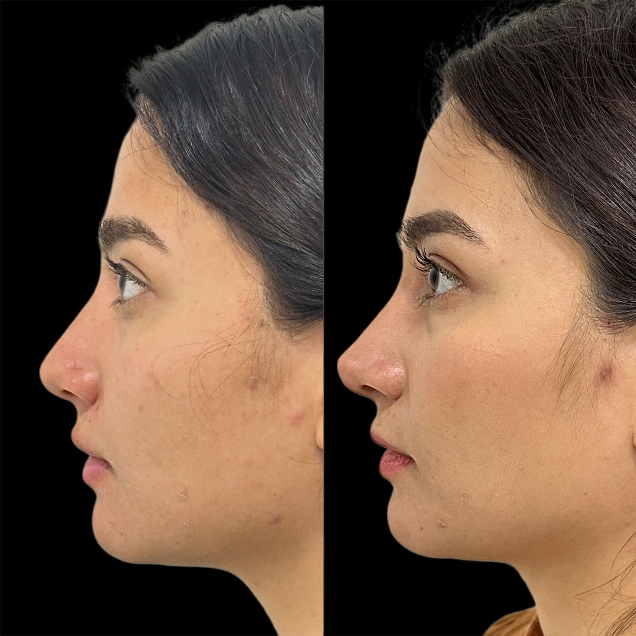 Ramiro Chávez Montoya-4