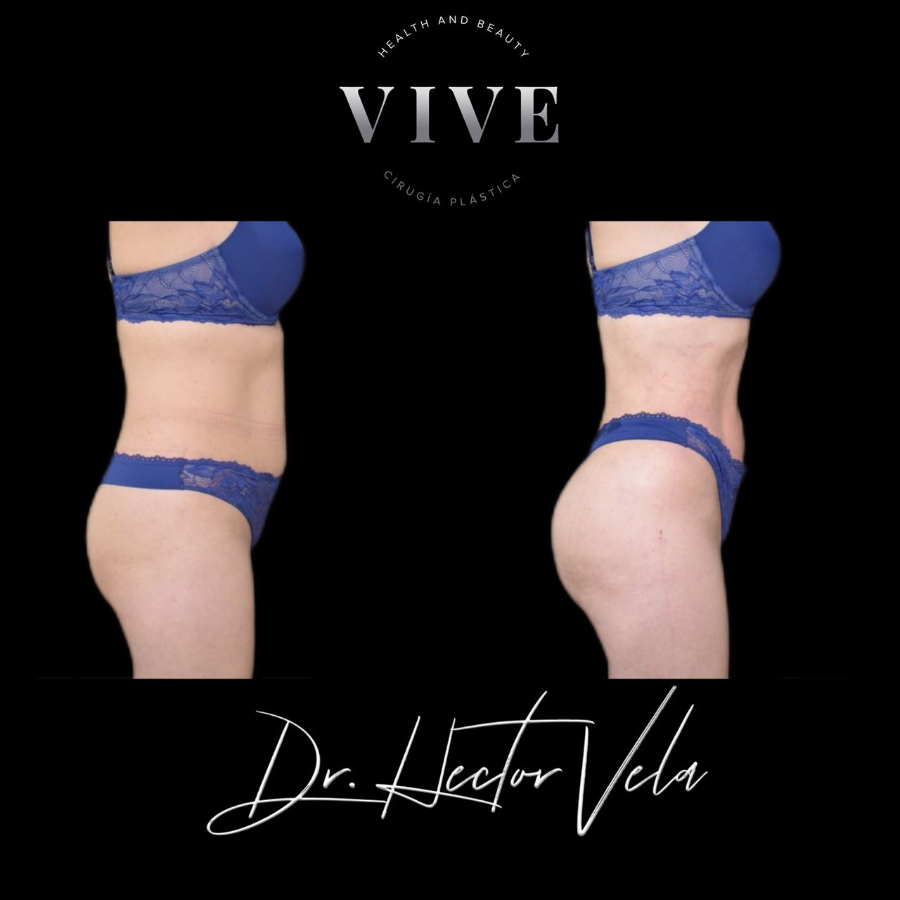 Héctor Eduardo Vela Cardona-105