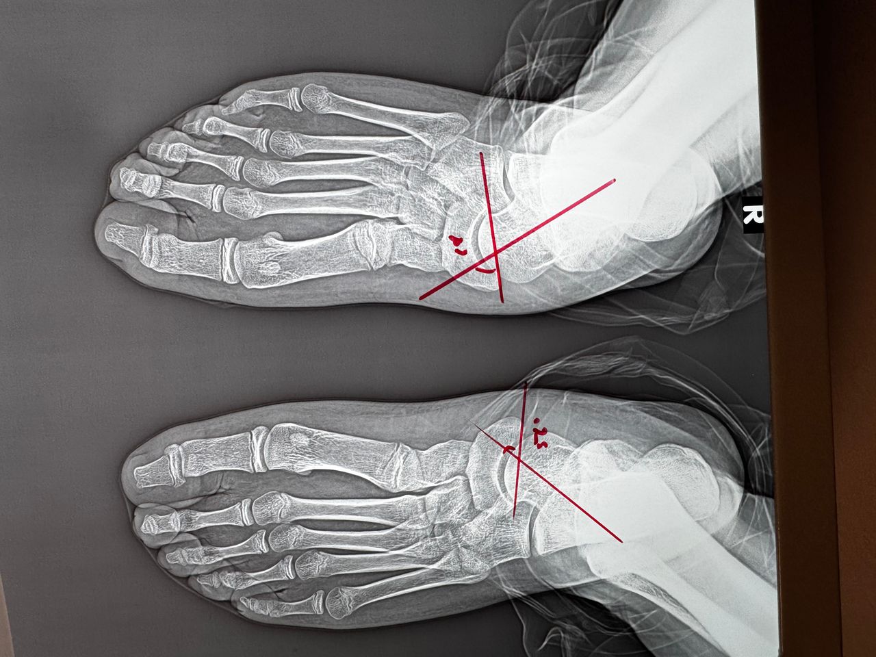 Luis Fernando Cortés Torres-1