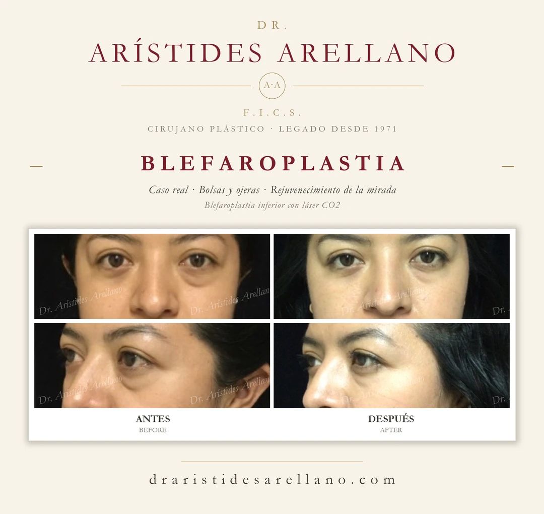 Arístides Arellano Huacuja-23
