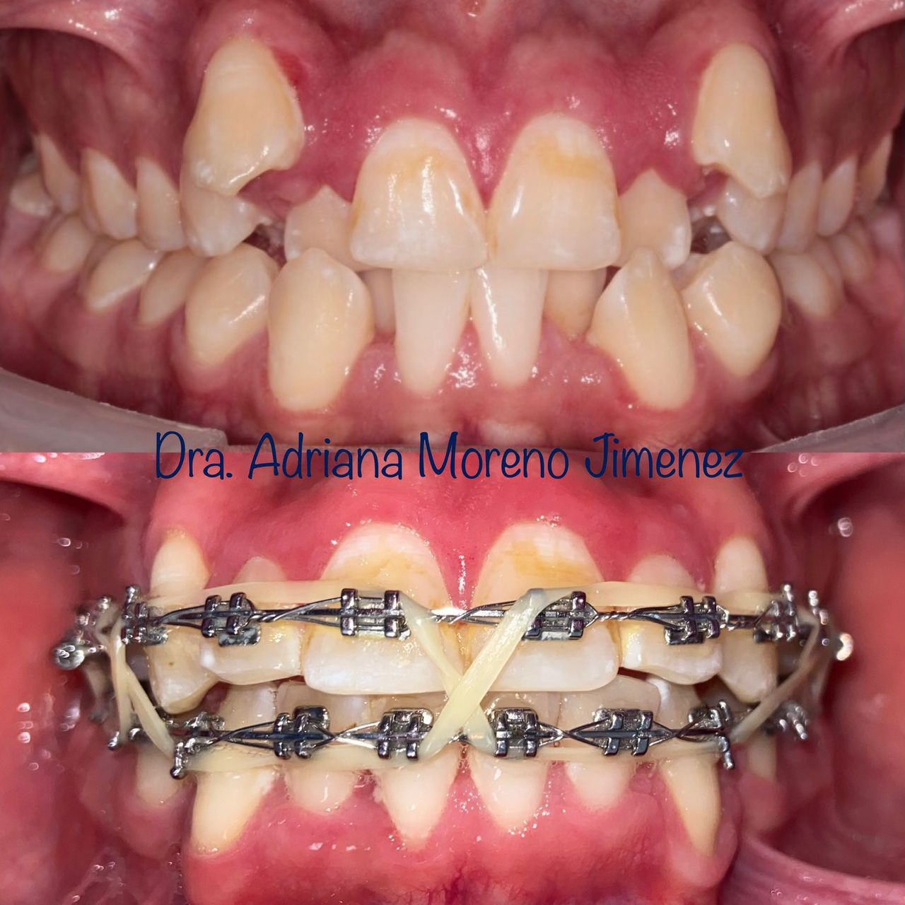 Adriana Moreno Jimenez-4