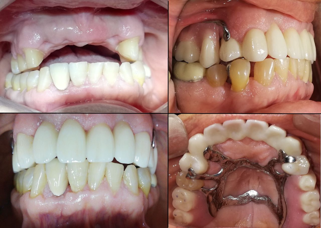 Adali Lopez Balderas-3