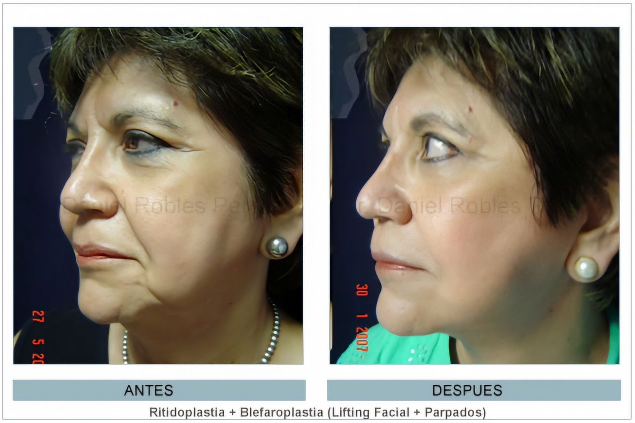 Daniel Robles Pereyra-1