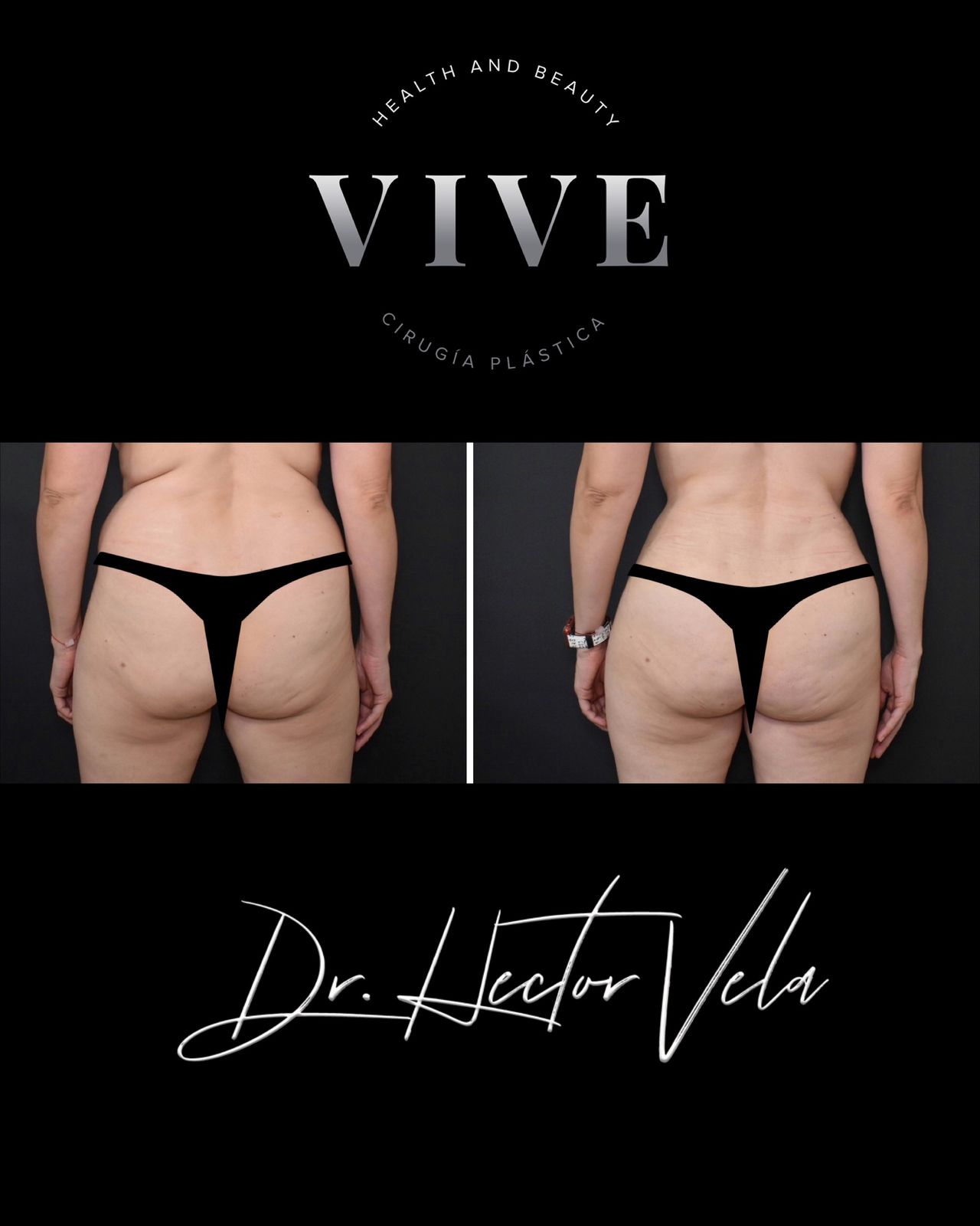 Héctor Eduardo Vela Cardona-271