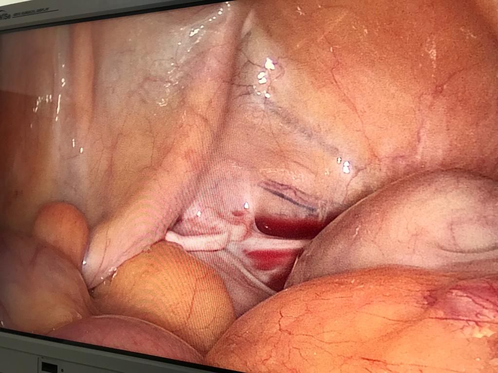 Alfonso Valdés Domínguez-10