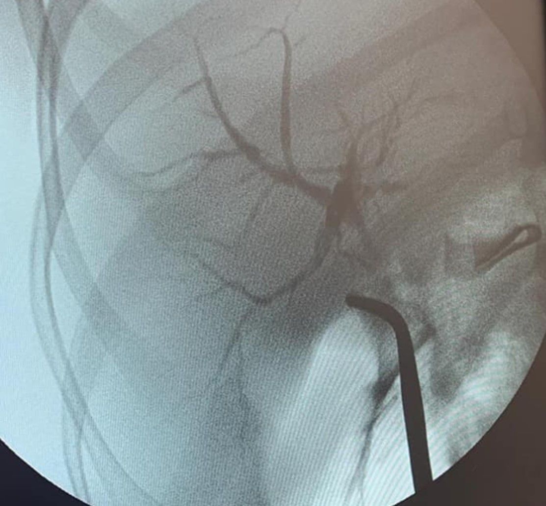 Edgar Gonzalo Beltran Campos-7